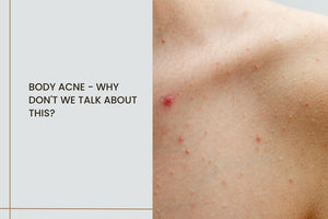 Body acne - why don't we talk about this?