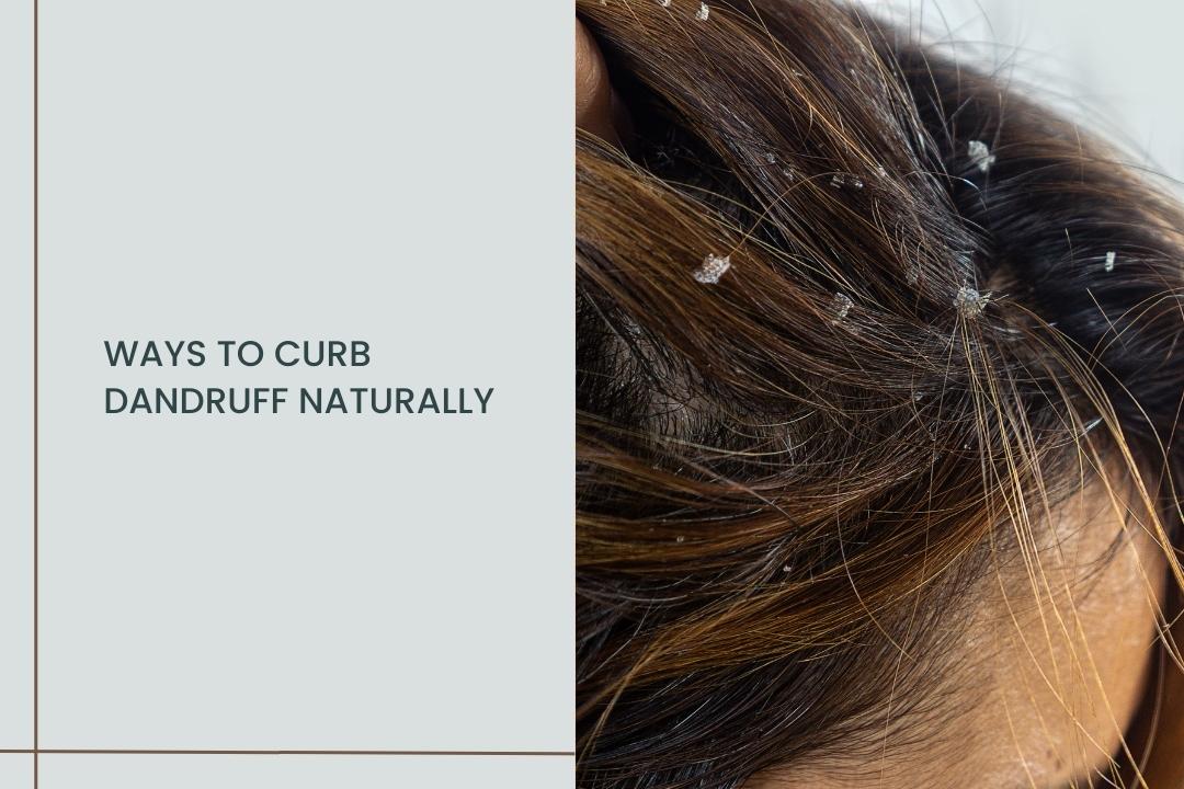 Ways to curb dandruff naturally